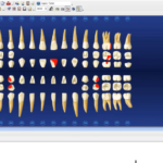crm for dentrix practice management software